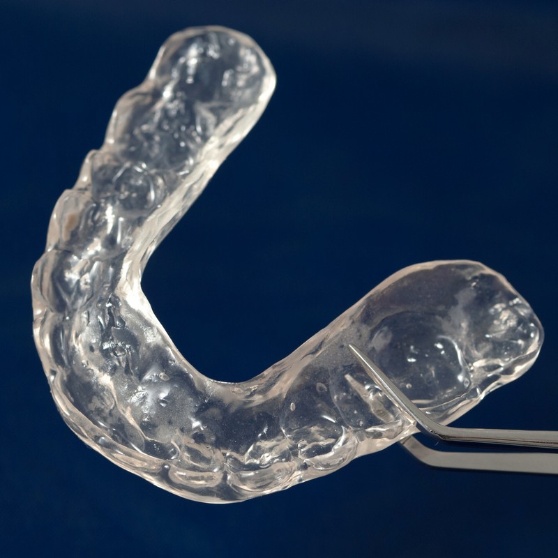 Night Guards in Fort Worth | Keller Crossing Dentistry