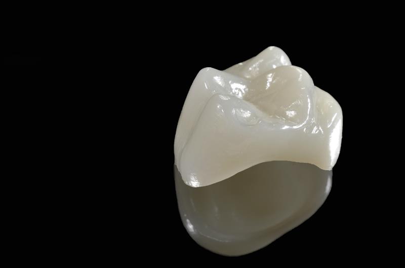 Porcelain Crowns in Fort Worth | Keller Crossing Dentistry
